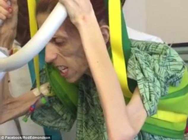 37χρονη με ανορεξία καταφέρνει να περπατήσει για πρώτη φορά μετά από μήνες [βίντεο] | iefimerida.gr 11