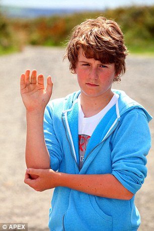 Εφηβος πέφτει από γκρεμό 30 μέτρων και τον δαγκώνει δηλητηριώδες φίδι - «Είχα μία πολύ κακή μέρα» δηλώνει [εικόνες] | iefimerida.gr 3