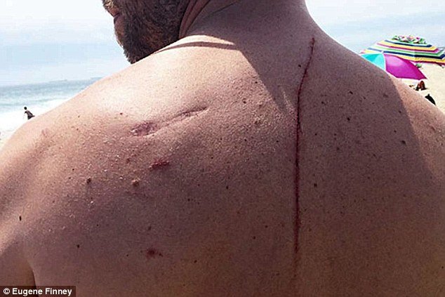 Παράδοξο: Η επίθεση καρχαρία του... έσωσε τη ζωή [εικόνες] | iefimerida.gr 0