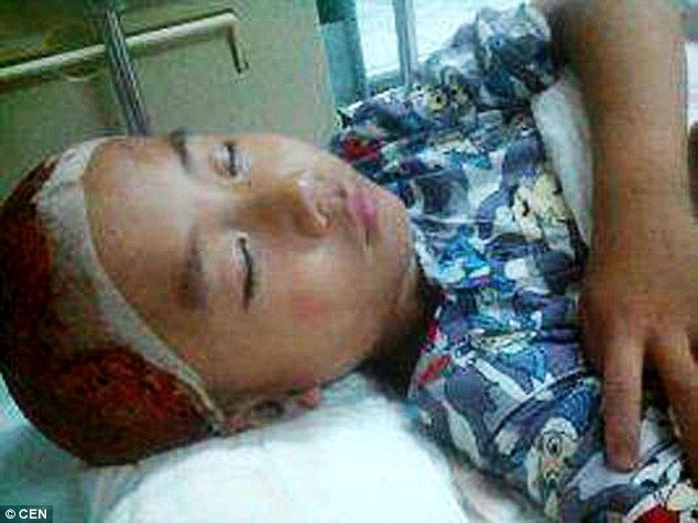 Μάθημα αγάπης στην Κίνα: Αδερφάκια έδωσαν δέρμα του κεφαλιού τους για να σώσουν τον πατέρα τους [εικόνες] | iefimerida.gr 1