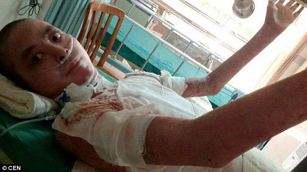 Μάθημα αγάπης στην Κίνα: Αδερφάκια έδωσαν δέρμα του κεφαλιού τους για να σώσουν τον πατέρα τους [εικόνες] | iefimerida.gr 0