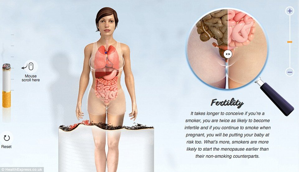 Οι τρομακτικές επιδράσεις του τσιγάρου στο σώμα σε ένα γράφημα - Τα όργανα ενός καπνιστή και ενός μη καπνιστή [εικόνες] | iefimerida.gr 2