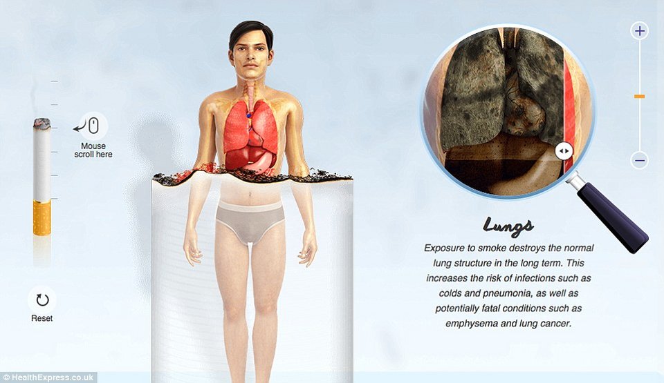 Οι τρομακτικές επιδράσεις του τσιγάρου στο σώμα σε ένα γράφημα - Τα όργανα ενός καπνιστή και ενός μη καπνιστή [εικόνες] | iefimerida.gr 5