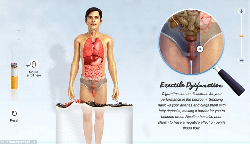 Οι τρομακτικές επιδράσεις του τσιγάρου στο σώμα σε ένα γράφημα - Τα όργανα ενός καπνιστή και ενός μη καπνιστή [εικόνες] | iefimerida.gr 7