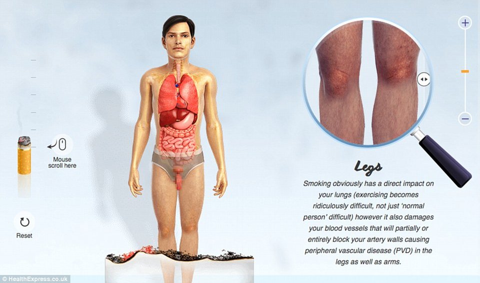 Οι τρομακτικές επιδράσεις του τσιγάρου στο σώμα σε ένα γράφημα - Τα όργανα ενός καπνιστή και ενός μη καπνιστή [εικόνες] | iefimerida.gr 8