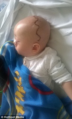 Το «παιδί-Πινόκιο» – Ο εγκέφαλός του μεγαλώνει στη μύτη του [εικόνες] | iefimerida.gr 6