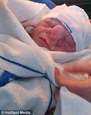 Το «παιδί-Πινόκιο» – Ο εγκέφαλός του μεγαλώνει στη μύτη του [εικόνες] | iefimerida.gr 1