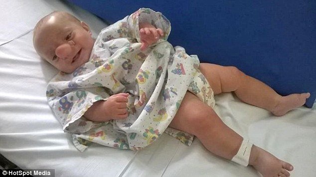 Το «παιδί-Πινόκιο» – Ο εγκέφαλός του μεγαλώνει στη μύτη του [εικόνες] | iefimerida.gr 2