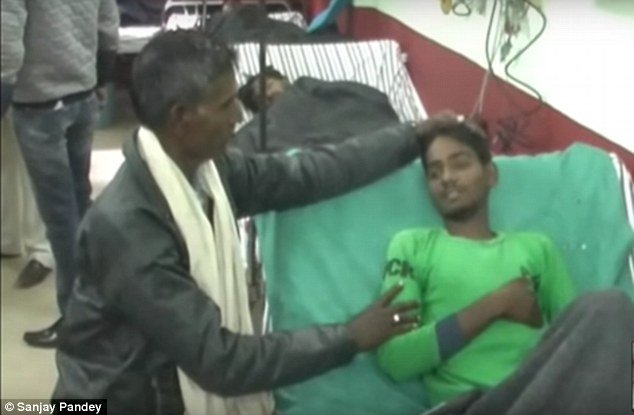 Σοκαριστικές εικόνες: Κουβαλούσε επί 18 χρόνια στο στομάχι του τον δίδυμο αδελφό του [εικόνες] | iefimerida.gr 0