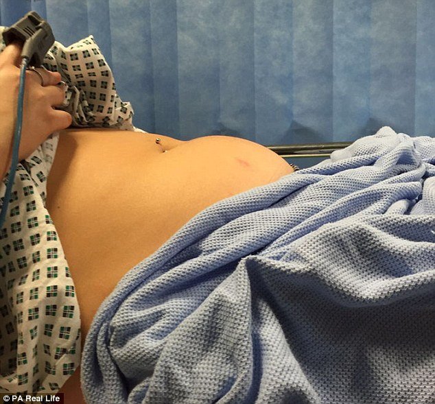 20χρονη ξέχασε να βγάλει το ταμπόν επί 9 ημέρες -Παρέλυσε για καιρό [εικόνες] | iefimerida.gr 5