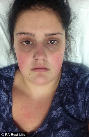 20χρονη ξέχασε να βγάλει το ταμπόν επί 9 ημέρες -Παρέλυσε για καιρό [εικόνες] | iefimerida.gr 3