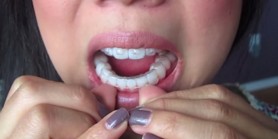 Δεν είναι μόνο το στέμμα -Τα 16 προνόμια της Μις Υφήλιος: Σπίτι, μισθός, ταξίδια, διαμάντια... [εικόνες] | iefimerida.gr 16