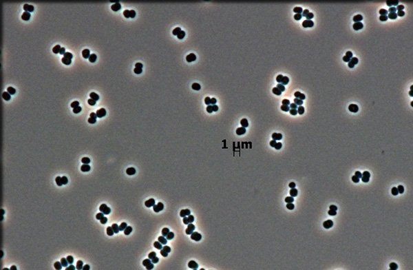 Αυτά είναι τα 10 σημαντικότερα νέα είδη που ανακαλύφθηκαν στη Γη μέσα στο 2013 [εικόνες] | iefimerida.gr 7