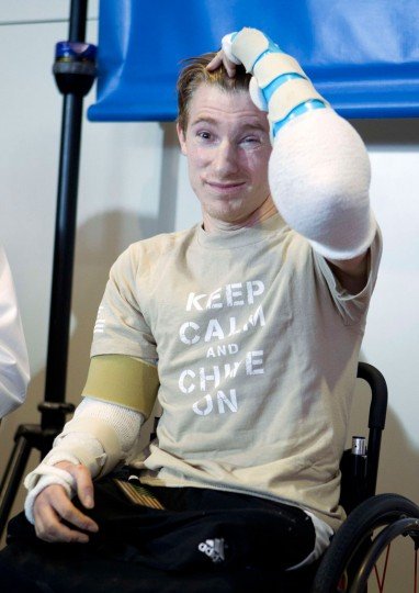 Καινούρια χέρια απέκτησε βετεράνος του Ιρακ χάρη σε αμερικάνους επιστήμονες [εικόνα] | iefimerida.gr 0