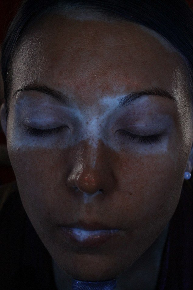 Φωτογραφίες που βοηθούν στην αποφυγή καρκίνου του δέρματος -Πώς προστατεύει το αντηλιακό [εικόνες] | iefimerida.gr 2