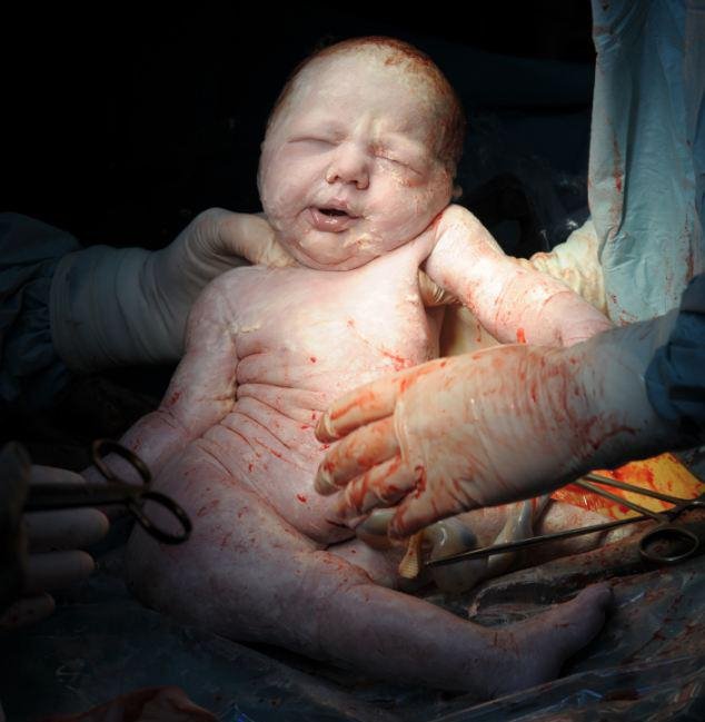 Η πρώτη ανάσα: Συγκλονιστικές φωτογραφίες καταγράφουν το θαύμα της γέννησης [εικόνες] | iefimerida.gr 2