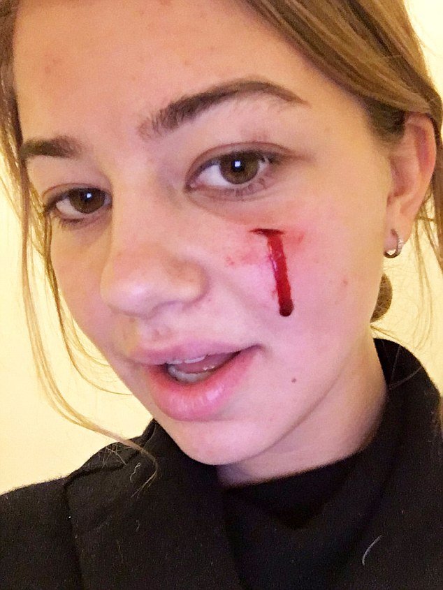 Η σκυλίτσα των Ομπάμα δάγκωσε μια 18χρονη που πήγε να τη χαϊδέψει [εικόνες] | iefimerida.gr 3