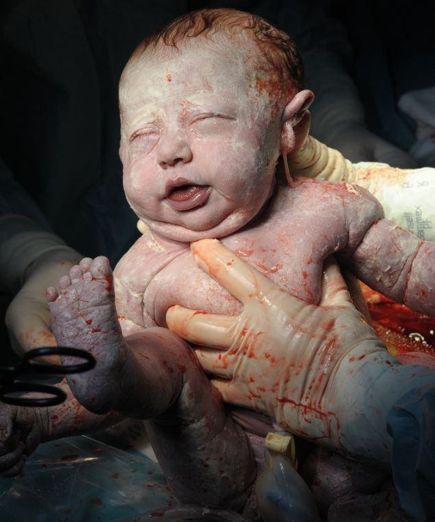 Η πρώτη ανάσα: Συγκλονιστικές φωτογραφίες καταγράφουν το θαύμα της γέννησης [εικόνες] | iefimerida.gr 3