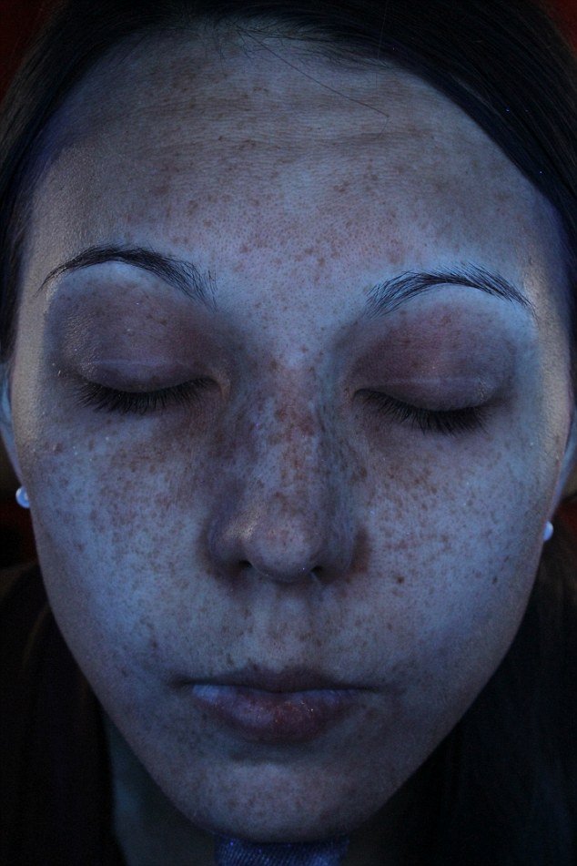 Φωτογραφίες που βοηθούν στην αποφυγή καρκίνου του δέρματος -Πώς προστατεύει το αντηλιακό [εικόνες] | iefimerida.gr 3