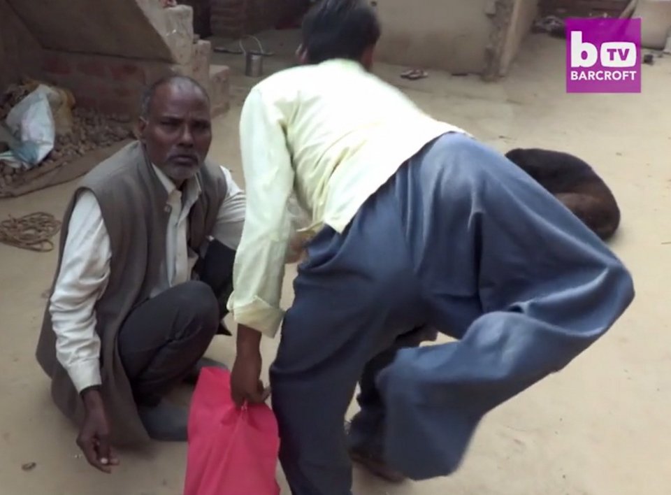 Ο Ινδός με τα τέσσερα πόδια -Κάνει έκκληση στους γιατρούς να του τα αφαιρέσουν [εικόνες & βίντεο] | iefimerida.gr 2