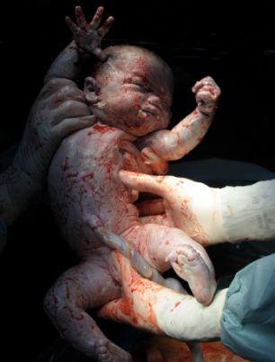 Η πρώτη ανάσα: Συγκλονιστικές φωτογραφίες καταγράφουν το θαύμα της γέννησης [εικόνες] | iefimerida.gr 4