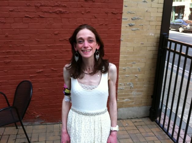 «Επρεπε να χωρέσω στο νυφικό μου 2 σακούλες οστομίας» -Μια νεαρή μιλά για τη μέρα του γάμου της [εικόνες] | iefimerida.gr 3