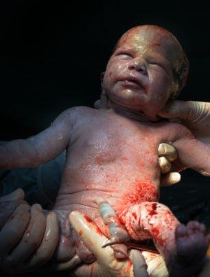 Η πρώτη ανάσα: Συγκλονιστικές φωτογραφίες καταγράφουν το θαύμα της γέννησης [εικόνες] | iefimerida.gr 5