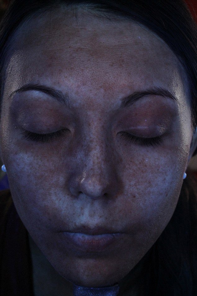 Φωτογραφίες που βοηθούν στην αποφυγή καρκίνου του δέρματος -Πώς προστατεύει το αντηλιακό [εικόνες] | iefimerida.gr 5