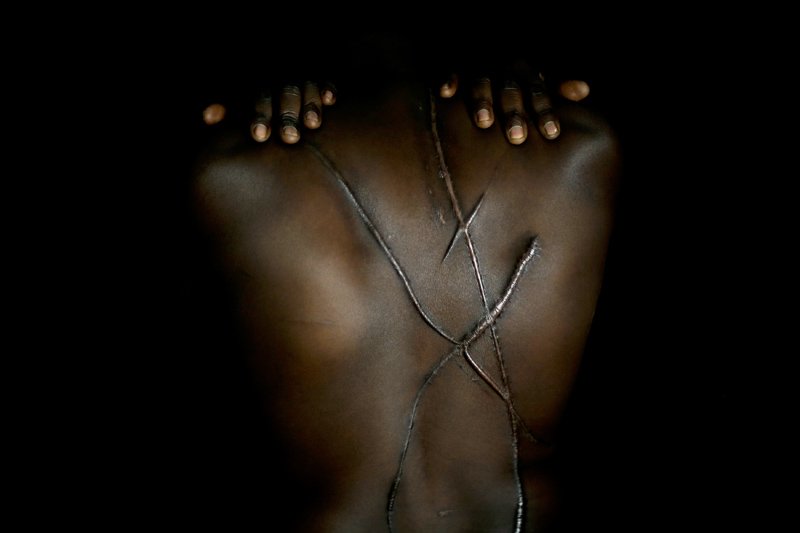 Το δεύτερο διεθνές βραβείο πήρε η φωτογραφία του Μπεχράκη με τον Σουδανό που του χαράκωσαν την πλάτη [εικόνα] | iefimerida.gr 0