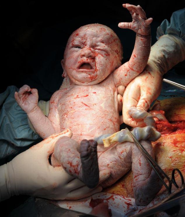 Η πρώτη ανάσα: Συγκλονιστικές φωτογραφίες καταγράφουν το θαύμα της γέννησης [εικόνες] | iefimerida.gr 6