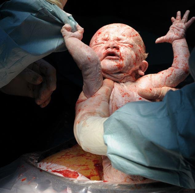 Η πρώτη ανάσα: Συγκλονιστικές φωτογραφίες καταγράφουν το θαύμα της γέννησης [εικόνες] | iefimerida.gr 8