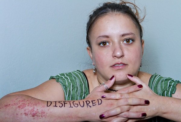 Φωτογραφίζοντας τις ανασφάλειες: Καθημερινοί άνθρωποι βγάζουν τις φοβίες τους στο φακό [εικόνες] | iefimerida.gr 5