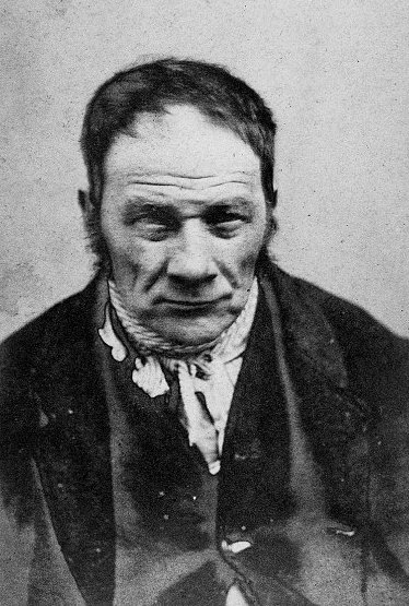 Το βάρβαρο πρόσωπο ενός ασύλου – Εκεί που έκλειναν ασθενείς με απλή μελαγχολία [εικόνες]  | iefimerida.gr 7