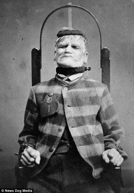 Το βάρβαρο πρόσωπο ενός ασύλου – Εκεί που έκλειναν ασθενείς με απλή μελαγχολία [εικόνες]  | iefimerida.gr 2