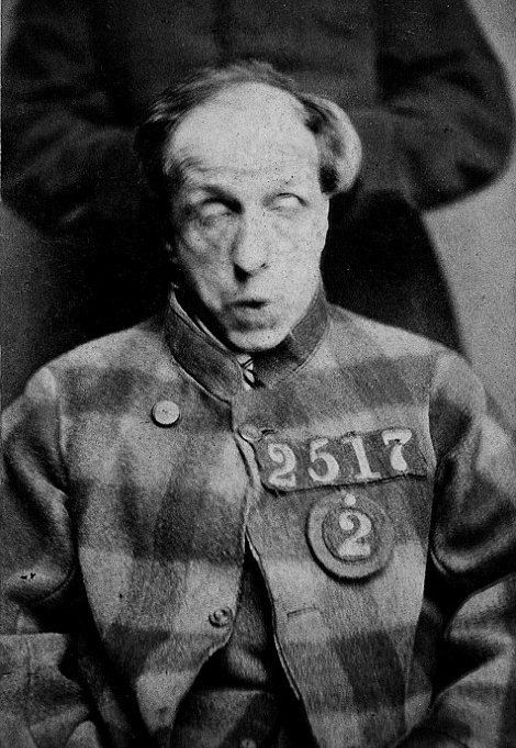 Το βάρβαρο πρόσωπο ενός ασύλου – Εκεί που έκλειναν ασθενείς με απλή μελαγχολία [εικόνες]  | iefimerida.gr 1