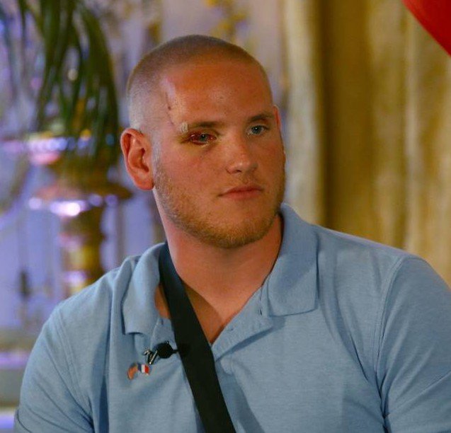 Ενας από τους ήρωες της υπερταχείας Thalys μαχαιρώθηκε στο Σακραμέντο [εικόνες] | iefimerida.gr 0