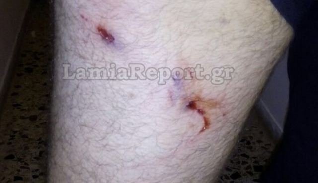 Στυλίδα: Αδέσποτα σκυλιά επιτέθηκαν και δάγκωσαν 34χρονο [εικόνες] | iefimerida.gr 1