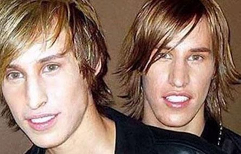 Δίδυμοι ξόδεψαν 15.000 δολ. σε πλαστικές για να μοιάσουν στον Μπραντ Πιτ [εικόνες] | iefimerida.gr 2