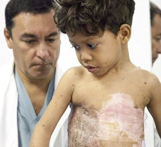 Οι γιατροί χάρισαν μια νέα ζωή στο «αγόρι - χελώνα» [εικόνες] | iefimerida.gr 1