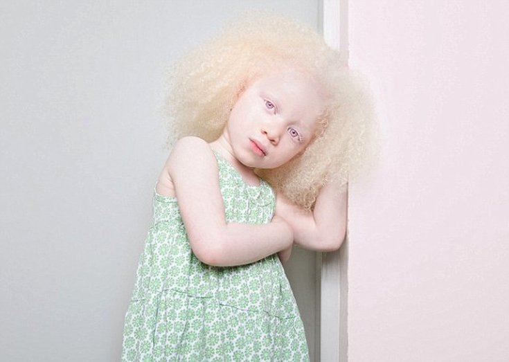 Η ομορφιά των αλμπίνων [εικόνες] | iefimerida.gr 2