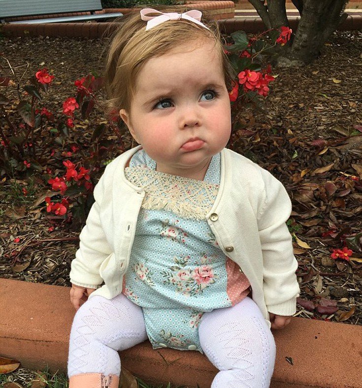 Το κοριτσάκι που έχει αλλεργία σε όλα τα φαγητά -Ακόμα και στο μητρικό γάλα [εικόνες]  | iefimerida.gr 1