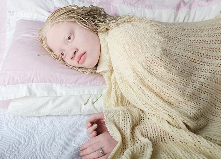 Η ομορφιά των αλμπίνων [εικόνες] | iefimerida.gr 5