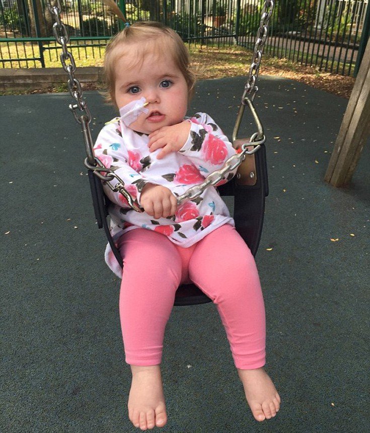 Το κοριτσάκι που έχει αλλεργία σε όλα τα φαγητά -Ακόμα και στο μητρικό γάλα [εικόνες]  | iefimerida.gr 7