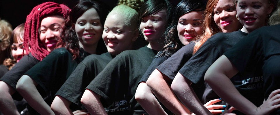 Για πρώτη φορά: Εξελέγησαν Μίστερ και Μις Αλμπίνοι στην Κένυα [εικόνες] | iefimerida.gr 1