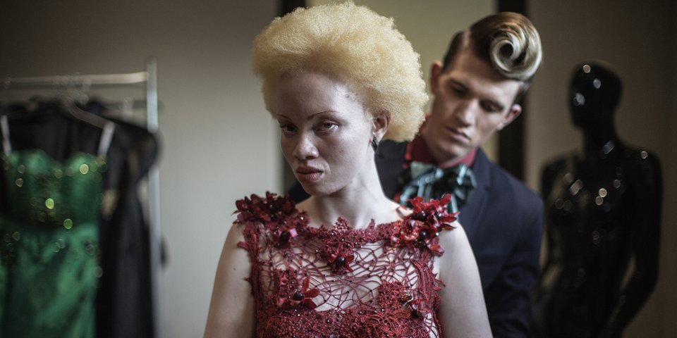 Για πρώτη φορά: Εξελέγησαν Μίστερ και Μις Αλμπίνοι στην Κένυα [εικόνες] | iefimerida.gr 3