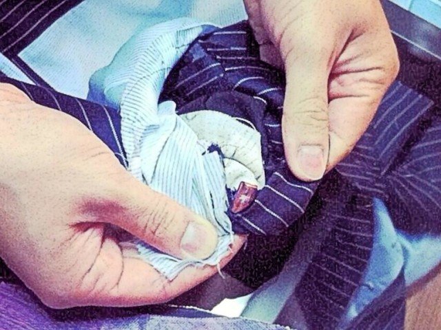 Αλεξίσφαιρα κοστούμια που προστατεύουν από σφαίρες 9 mm από περίστροφο [εικόνες] | iefimerida.gr 1