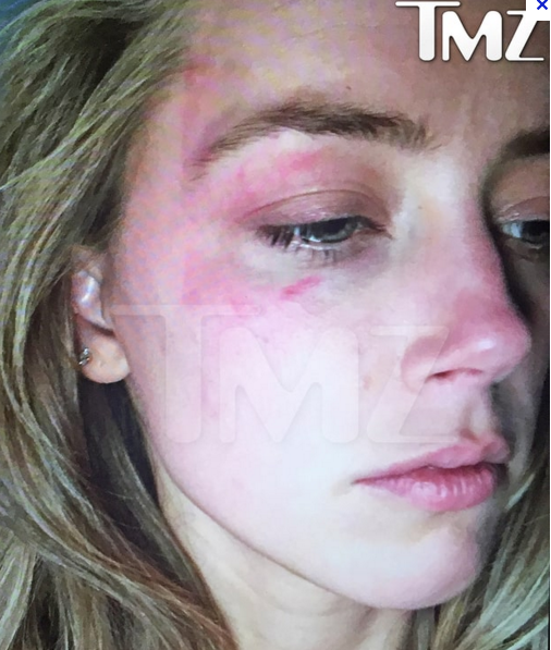 Οι δύο διασημότεροι διαζευγμένοι του πλανήτη: Πώς έγιναν ράκη μετά τον χωρισμό [εικόνες] | iefimerida.gr 1