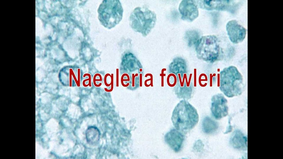 ΗΠΑ: 18χρονη πέθανε από αμοιβάδα -Την κόλλησε από το νερό [εικόνες & βίντεο] | iefimerida.gr 3