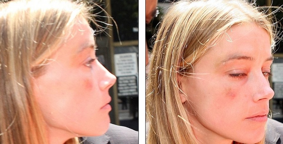 «Με έδερνε» -H Aμπερ Χέρντ ξεσπά κατά του Τζόνι Ντεπ [εικόνες] | iefimerida.gr 0