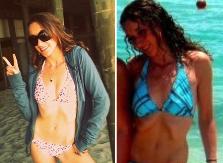 Η συγκλονιστική ιστορία μιας Βρετανίδας– Αρχισε δίαιτα στα 10, ζύγιζε 29 κιλά και έπαθε έμφραγμα στα 17 [εικόνες]  | iefimerida.gr 4